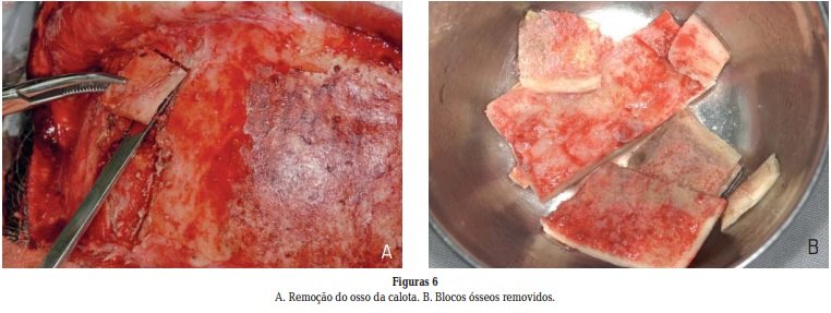 Imagem do artigo