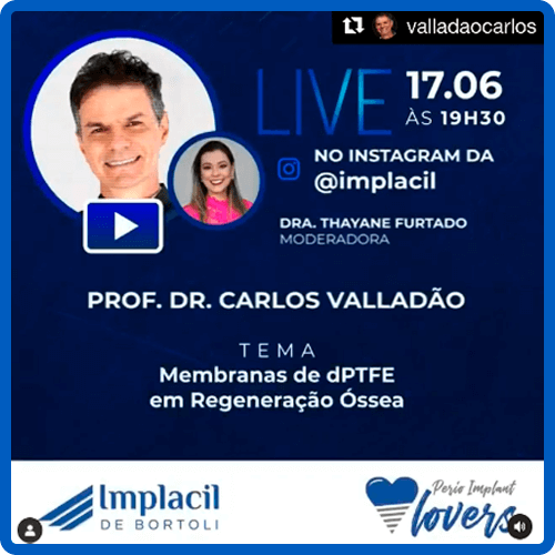 Perio Implant Lovers - 17-06-2020 - Carlos Valladão - membranas de dPTFE em Regeneração Óssea